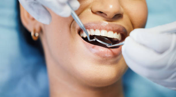 Best Same-Day Emergency Dentist in Wade Hampton, SC